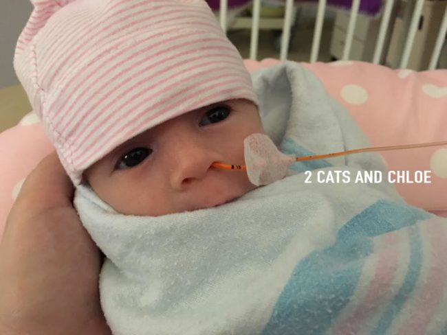 Baby with NG Tube: Feeding Tube Awareness Week