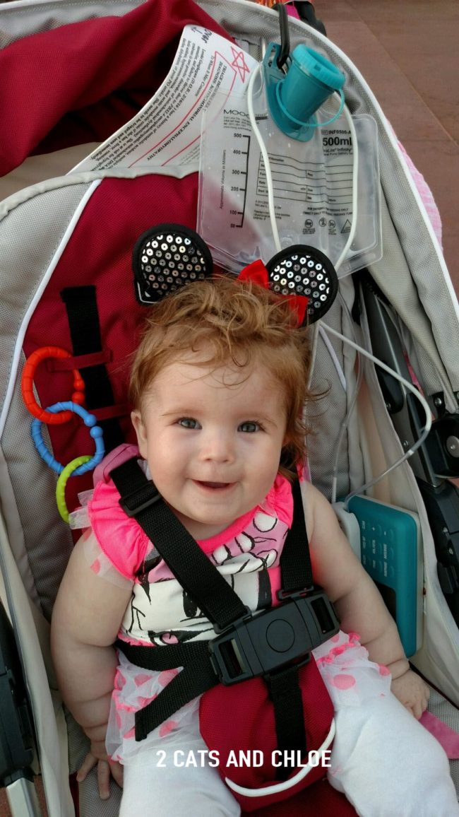 Baby with Feeding Tube: Feeding Tube Awareness
